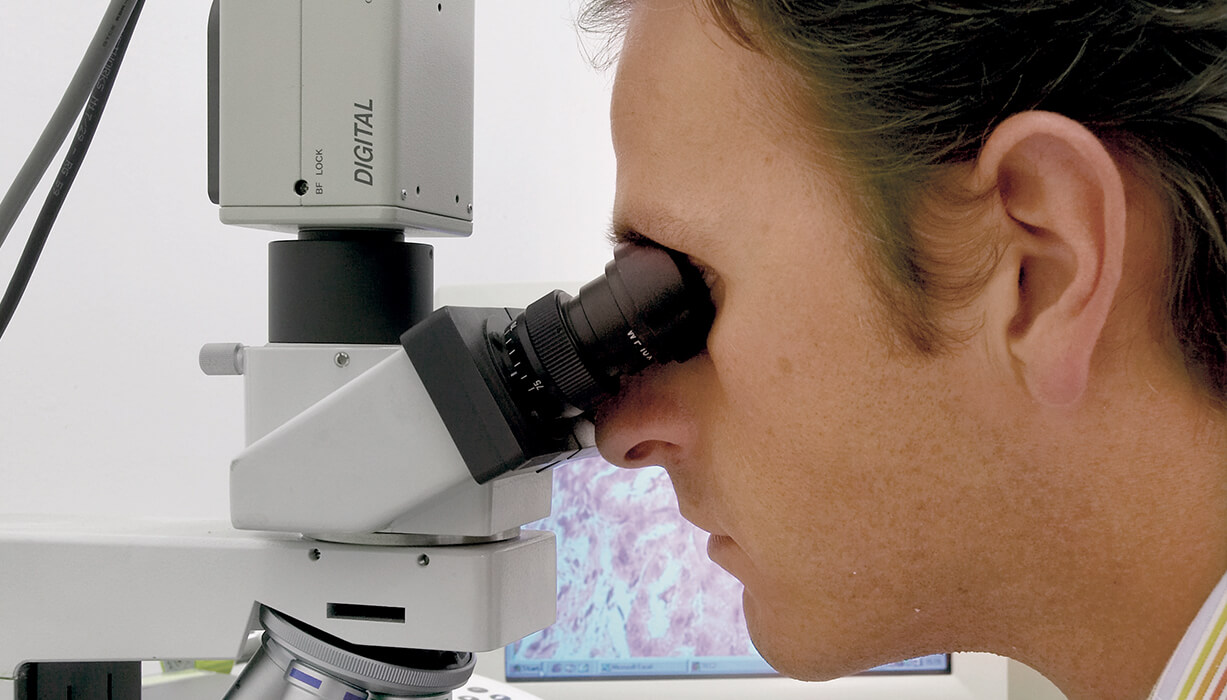 Test brevetti con microscopio